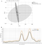 Figure 1. A) Results of principal component analysis (PCA) of the data matrix from the serum of testicular cancer (CS) patients (--▲--) versus healthy men (NS) (--n--) as control group. B) Average Raman spectra for serum of testicular cancer (―) patients and healthy groups (--). 2,800-3,000 cm-1 corresponds to the -CH group while 2,400-2,600 cm-1 relates to the -SH group (p-value &gt;0.05)